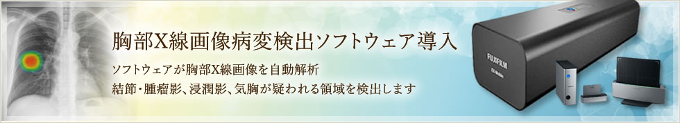 胸部X線画像病変検出ソフトウェアを導入しました