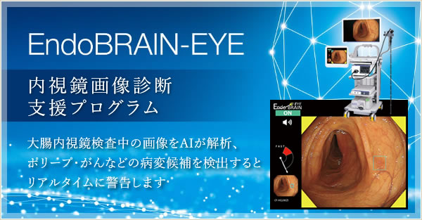 内視鏡画像診断支援プログラムEndoBRAIN-EYE 大腸内視鏡検査中の画像をAIが解析