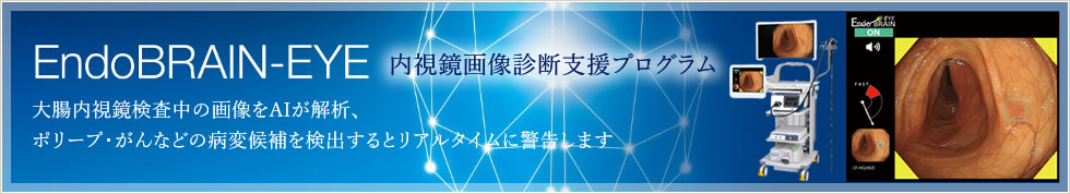 内視鏡画像診断支援プログラムEndoBRAIN-EYE 大腸内視鏡検査中の画像をAIが解析